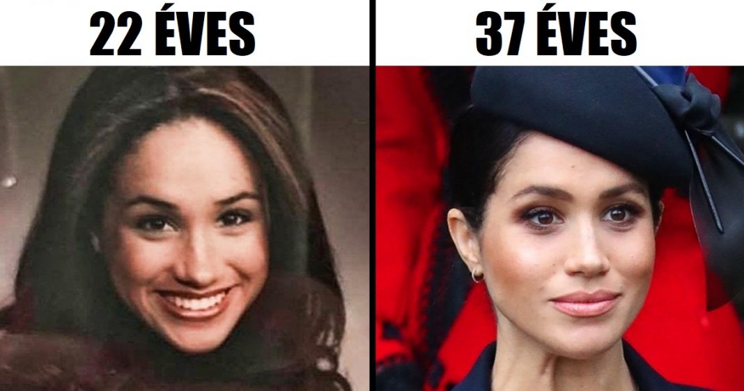 Hogyan néztek ki a kedvenc hírességeink a húszas éveik elején Hogyan néztek ki a kedvenc hírességeink a húszas éveik elején