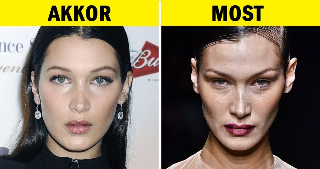 17 híresség, akik úgy döntöttek, hogy búcsút mondanak pufók arcuknak
