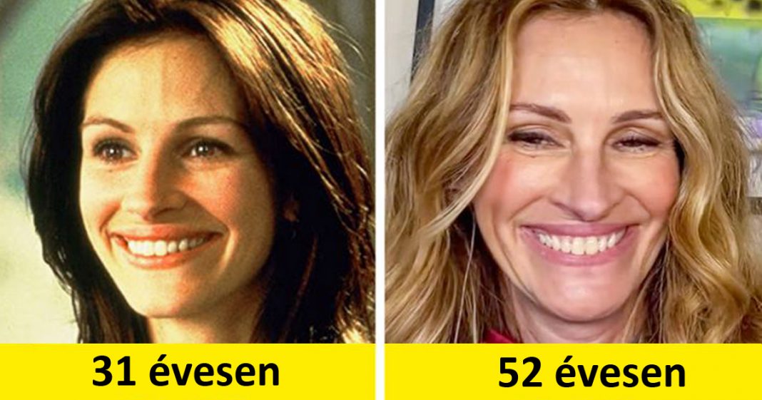 11 HÍRESSÉG, AKIK ELKERÜLTÉK A PLASZTIKÁT, INKÁBB FELVÁLLALJÁK A TERMÉSZETES SZÉPSÉGÜKET 11 HÍRESSÉG, AKIK ELKERÜLTÉK A PLASZTIKÁT, INKÁBB FELVÁLLALJÁK A TERMÉSZETES SZÉPSÉGÜKET