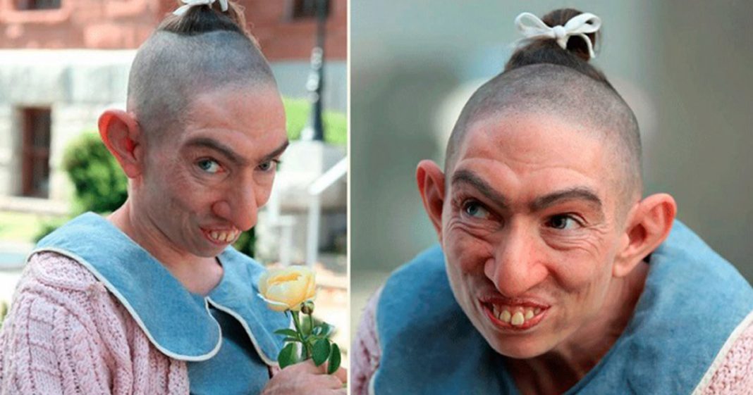 Ez a szép nő beleegyezett, hogy elcsúfítsák egy sorozatbeli szerepe miatt. Nézd meg milyen gyönyörű a valóságban! Ez a szép nő beleegyezett, hogy elcsúfítsák egy sorozatbeli szerepe miatt. Nézd meg milyen gyönyörű a valóságban!