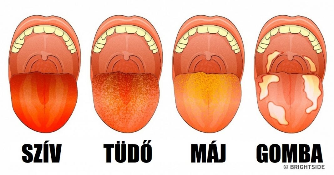 13 dolog, amit a nyelved próbál elmondani neked az egészségedről 13 dolog, amit a nyelved próbál elmondani neked az egészségedről