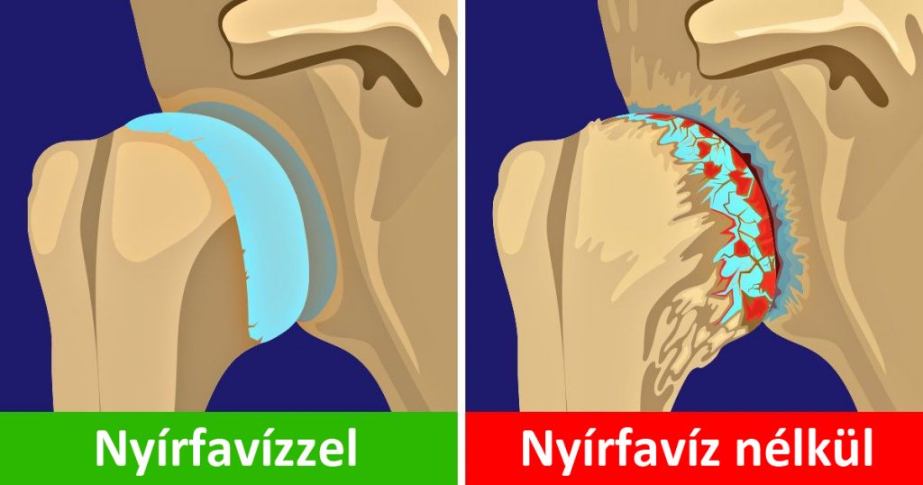 10 finom innivaló, amely végre rendbe teheti az egészséged