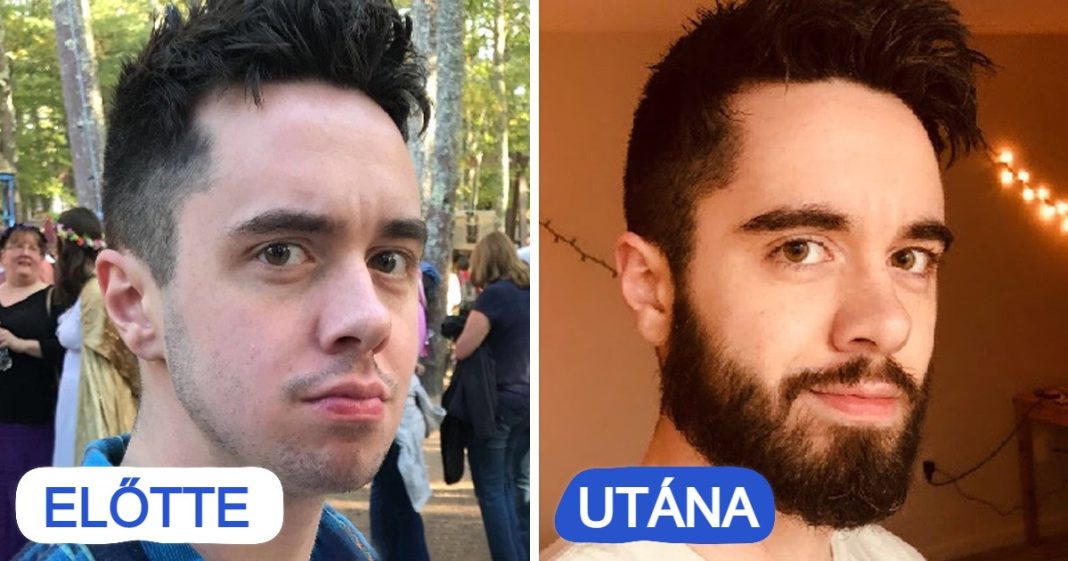 16 férfi, aki szakállat növesztett és ezzel teljesen megváltoztatta megjelenését 16 férfi, aki szakállat növesztett és ezzel teljesen megváltoztatta megjelenését